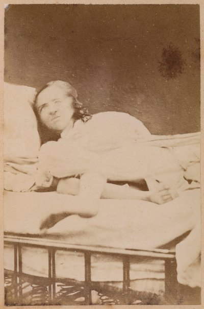 Hysterische Epilepsie, Verrenkungen, Tafel XXXVIII aus 