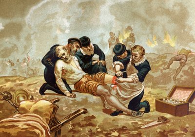 Ambroise Pare Arzt und französischer Chirurg (ca. 1509-1590) praktiziert die Ligatur von Arterien nach der Amputation. aus „Hombres y Mujeres celebres“. Barcelona 1877. von Unknown artist