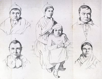 Überlegungen zu den Ursachen des endemischen Kretinismus von Morel. von Unknown artist
