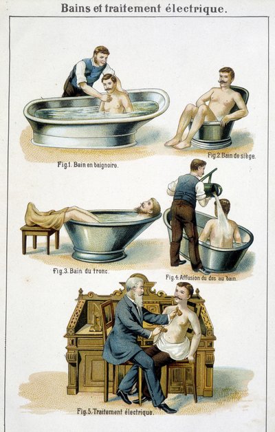 Bäder und elektrische Behandlung: 1) Badewanne, 2) Sitzbad, 3) Rumpfbad, 4) Rückenbad, 5) Elektrische Behandlung - in „Bilz, Naturheilkunde“, Ende des 19. Jahrhunderts von Unknown artist