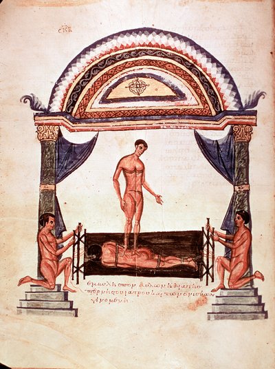 Medizin: Reduktion einer ausgerenkten Wirbelsäule - der Patient wird auf einem Holzbrett fixiert, einer der Therapeuten steht auf seinem Rücken (Manuskript) von Unknown artist