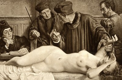 Hexerei. Wissenschaftler suchen nach einem Maulwurf auf dem Körper einer Hexe, um ihn zu kneifen und die Reaktion zu studieren. Illustration von E. Van Hoove. 1888 von Unknown artist