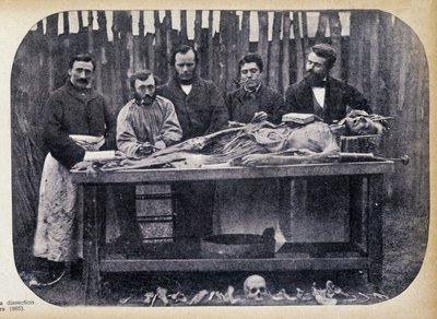 Dissektion, ca. 1865 von Unknown photographer