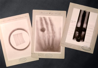 Originale Radiographien von Röntgen von Wilhelm (after) Röntgen