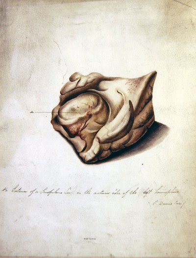Studie des Gehirns II, ca. 1850 von William Lover