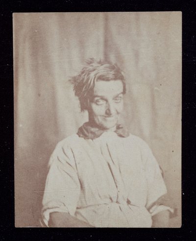 Psychiatrie Porträt eines Patienten, Surrey County Asylum, ca. 1852 von John Pardon