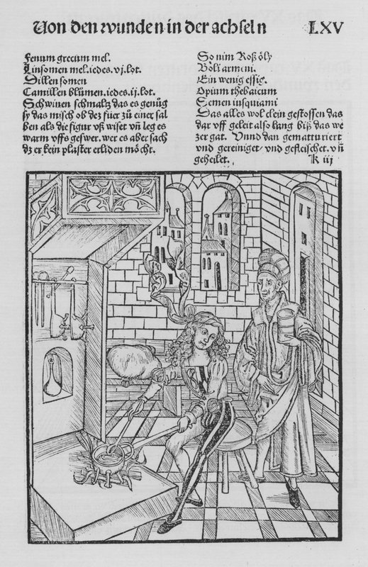 Das Buch der Chirurgie von Hieronymus Brunschwig von (after) German School