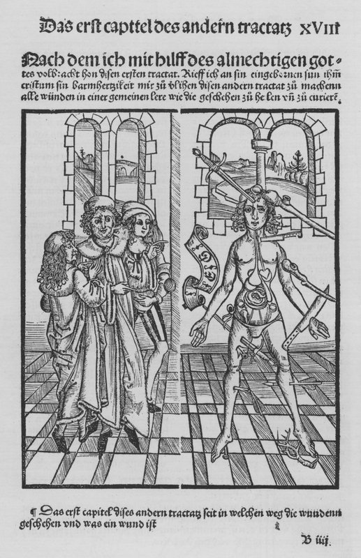 Das Buch der Chirurgie von Hieronymus Brunschwig von (after) German School
