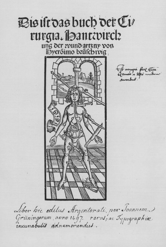 Das Buch der Chirurgie von Hieronymus Brunschwig von (after) German School