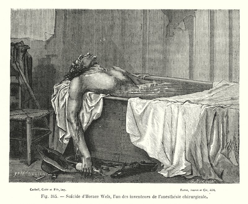 Selbstmord von Horace Wels, einem der Erfinder der chirurgischen Anästhesie (Stich) von European School
