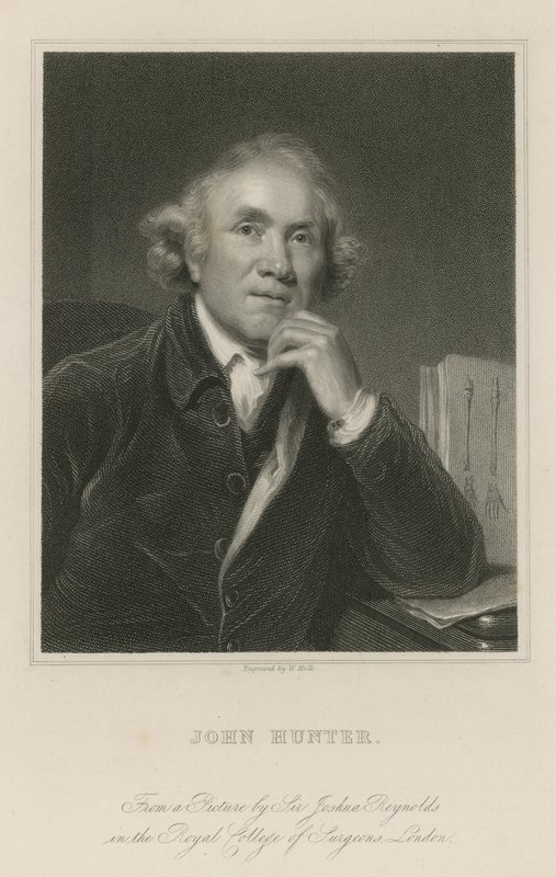 John Hunter von Joshua Reynolds
