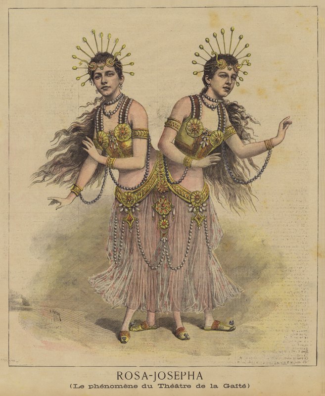 Siamesische Zwillinge von after Henri Meyer