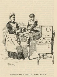 Das West End Hospital für Lähmung und Epilepsie, Welbeck Street, London: Methode zur Anwendung von Galvanismus