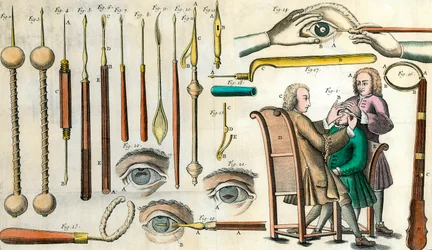 Chirurgie im 18. Jahrhundert: Augenoperation. Instrumente für die Kataraktoperation und künstliche Pupillenbildung. Gravur in „Institutionis chirurgicae“ von Lorenzo Heister