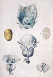 Krankheiten der Blase und Prostata, aus 