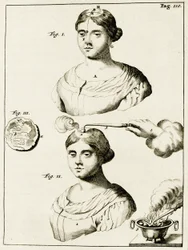 Behandlung eines Epilepsiekranken, aus Exercitationes Practicae circa Medendi Methodum von Frederik Dekkers, 1694