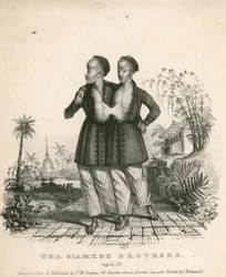 Chang und Eng, die siamesischen Jugendlichen, 18 Jahre alt