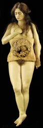 Anatomisches Modell einer Eileiterschwangerschaft