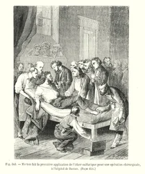 Morton führt die erste Anwendung von Schwefeläther für eine Operation im Bostoner Krankenhaus durch