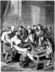 Erste chirurgische Operation mit Schwefelätheranästhesie im Boston Hospital, durchgeführt am 16. Oktober