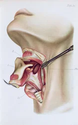 Tafel aus Atlas und Epitome der operativen Chirurgie von Dr. Otto Zuckerkandl (1861-1921) 1910