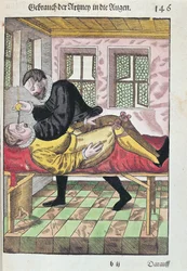 Augenoperation, aus Ophthalmodouleia von Georg Bartisch, veröffentlicht in Dresden 1583