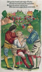 Entfernung eines Pfeils, Illustration aus Feldtbuch der Wundartzney von Hans von Gersdorff, 1540