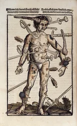 Der Wundmann, aus dem 