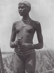Afrika: Nuer-Mädchen mit Zierschnitten