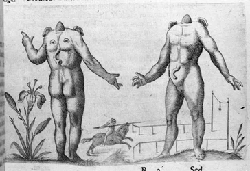 Verschiedene Arten von menschlichen Monstern: ein Mann ohne Kopf. Gravur aus „De monstrorum natura, causis et differentiis“ von Fortunio Liceti (1577-1656), italienischer Wissenschaftler. 1646