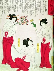 Schwangere Frauen, 1881