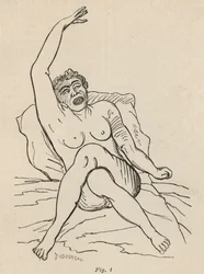 Hysterische Epilepsie, Anfall, Verrenkungen, Abb. 1 aus 