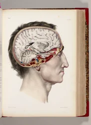 Eine handkolorierte Lithografie eines sezierten Kopfes im Profil mit Darstellung des Gehirns, aus „Traité complet de l