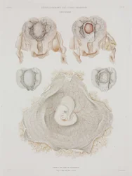 Gynäkologie: Menschliche Gebärmutter mit Embryo, ca. 1847-1859