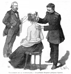 Professor Bergmann injiziert einem Tuberkulosepatienten, 1891