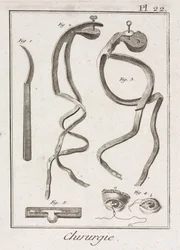 Ausrüstung, frühneuzeitliche Augenchirurgie