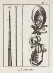 Ausrüstung, frühmoderne chirurgische Instrumente und Diagramme von Körperteilen
