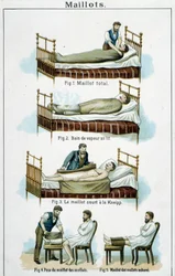 Trikots: 1) Ganzkörpertrikot, 2) Dampfbad im Bett, 3) Kneipp-Kurztrikot, 4-5) Waden-Trikot - in „Bilz, Naturheilkunde“, Ende des 19. Jahrhunderts