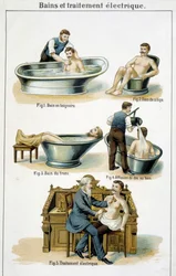 Bäder und elektrische Behandlung: 1) Badewanne, 2) Sitzbad, 3) Rumpfbad, 4) Rückenbad, 5) Elektrische Behandlung - in „Bilz, Naturheilkunde“, Ende des 19. Jahrhunderts