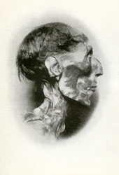 Kopf der Mumie von Ramses II., altägyptischer Pharao der 19. Dynastie, um 1212 v. Chr., 1926